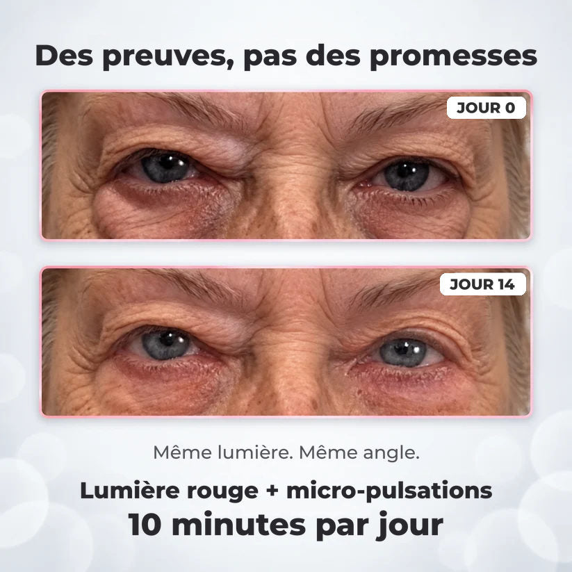 Des preuves, pas des promesses : jour 0 et jour 14