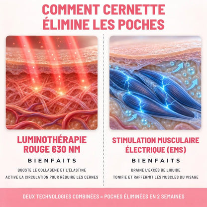 Comment Cernette élimine les poches : lumière rouge et micro-pulsations